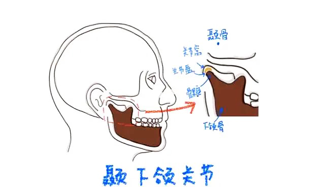 我真的笑得合不拢嘴了，是颞下颌关节紊乱综合征惹的祸