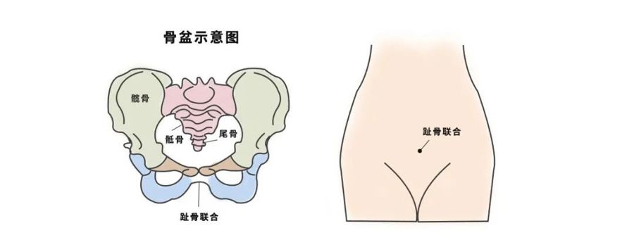 没有一种分离能比耻骨联合分离更让人痛彻心扉